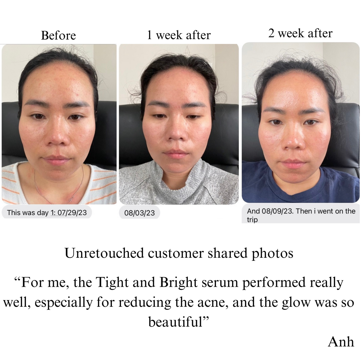Tight & Bright Phyto-Retinol + Vitamin C Face Serum