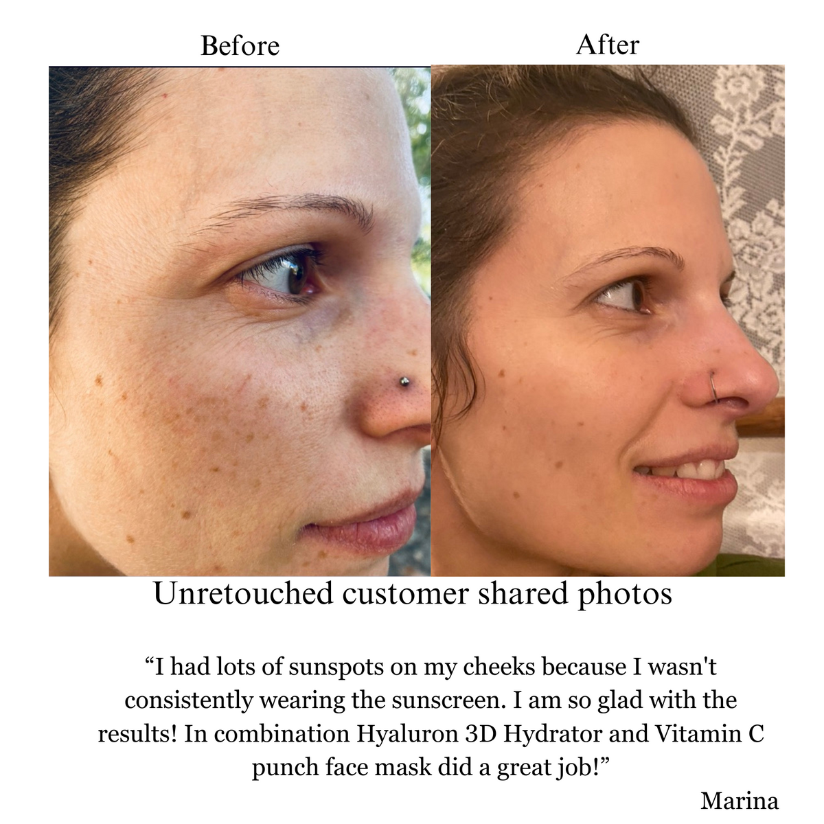 Hyaluron 3D Hydrator Face & Neck Cream-Serum