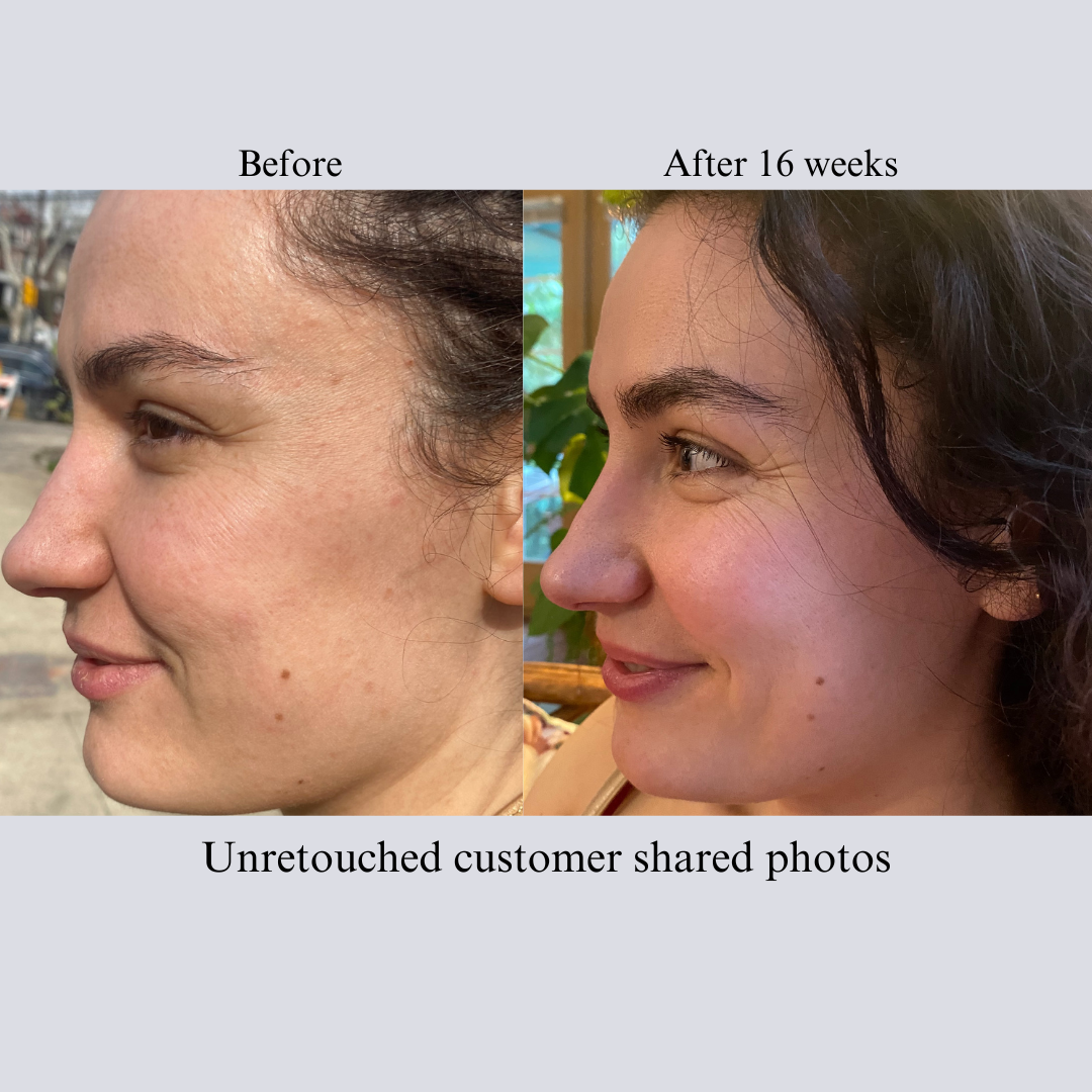 Hyaluron 3D Hydrator Face & Neck Cream-Serum